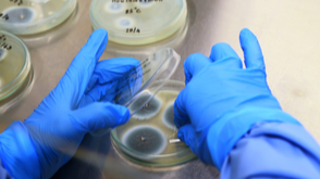 Mold Growth: What Should You Know About Mycotoxins?